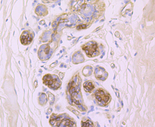 Integrin beta 4 Rabbit mAb