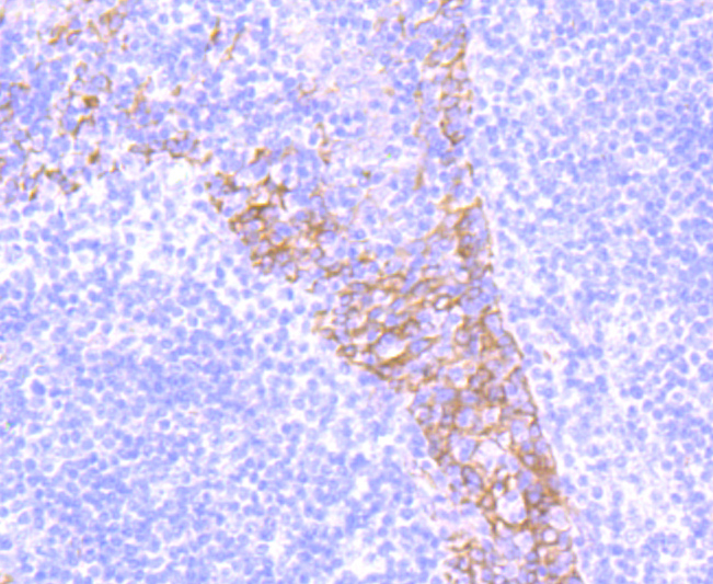 Integrin beta 4 Rabbit mAb