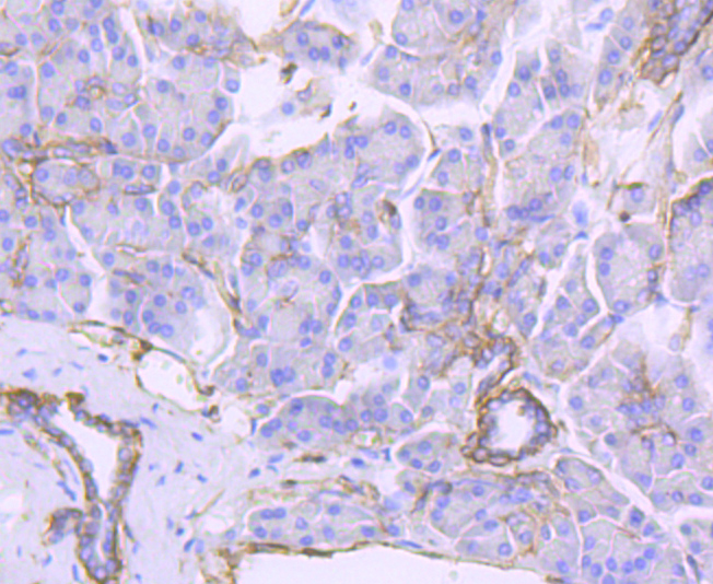 Integrin beta 4 Rabbit mAb