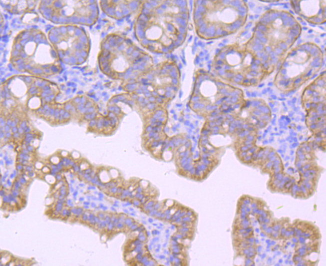 Integrin beta 4 Rabbit mAb