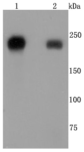 Integrin beta 4 Rabbit mAb