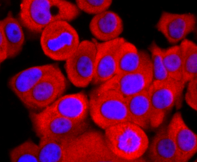 ATP5A1 Rabbit mAb