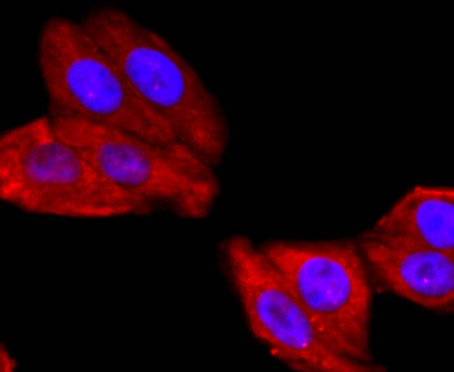 ATP5A1 Rabbit mAb