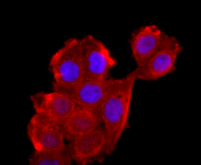 ATP5A1 Rabbit mAb