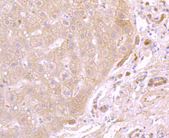 ATP5A1 Rabbit mAb