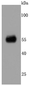 CaMKII alpha Rabbit mAb