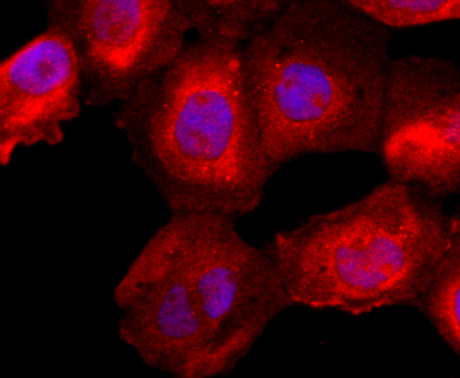 FKBP12 Rabbit mAb