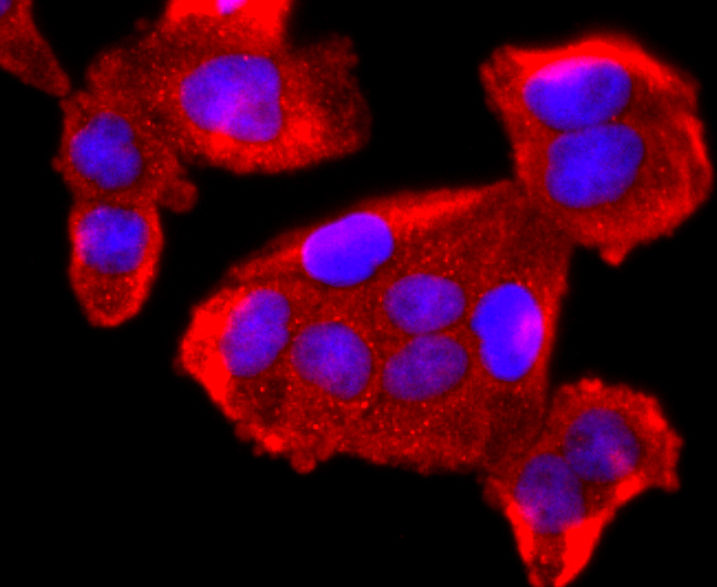 FKBP12 Rabbit mAb