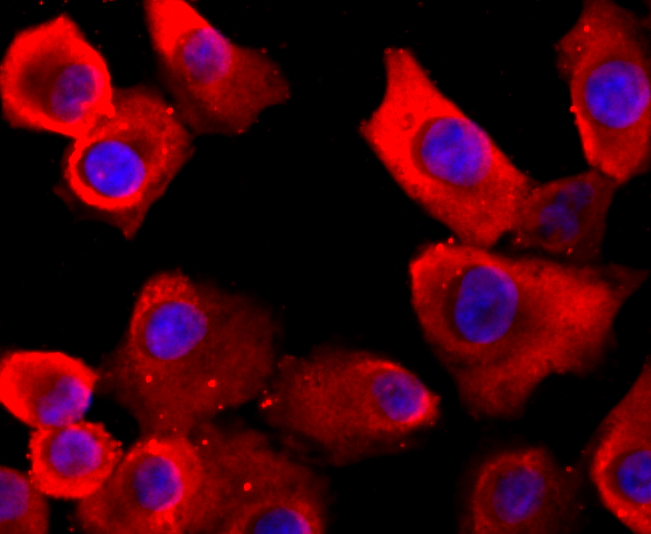 VCP Rabbit mAb