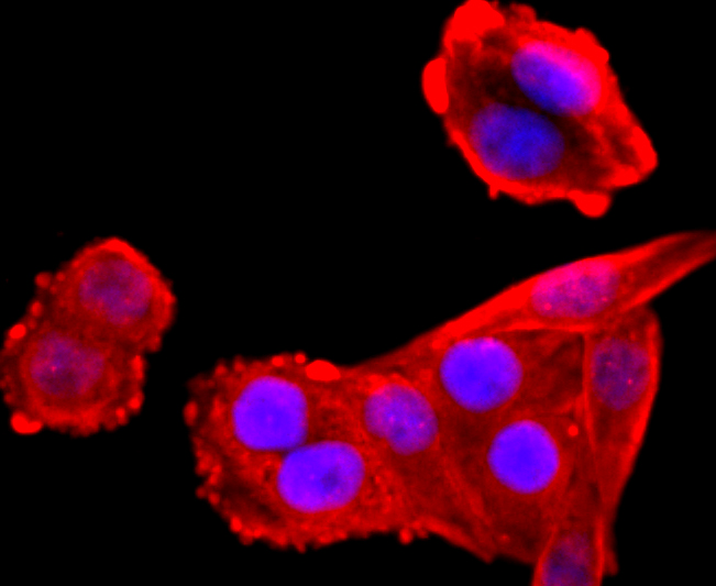 VCP Rabbit mAb