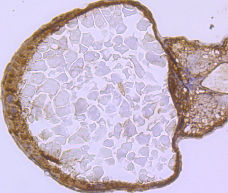 VCP Rabbit mAb