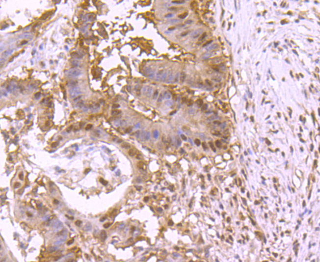 VCP Rabbit mAb