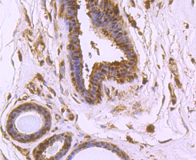 VCP Rabbit mAb