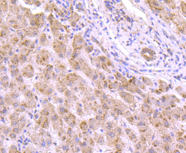 VCP Rabbit mAb