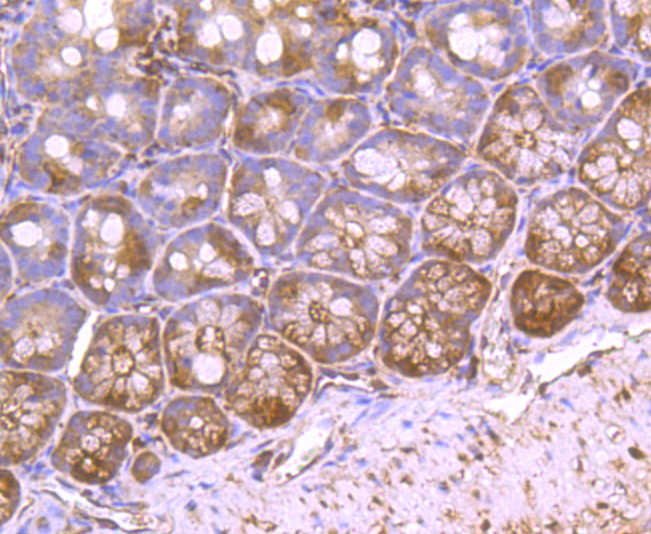 VCP Rabbit mAb