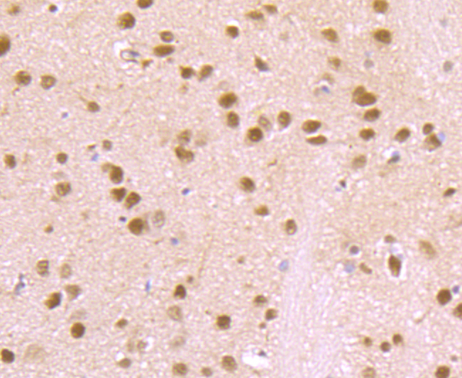 VCP Rabbit mAb