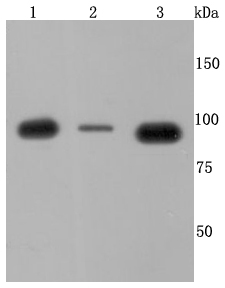 VCP Rabbit mAb