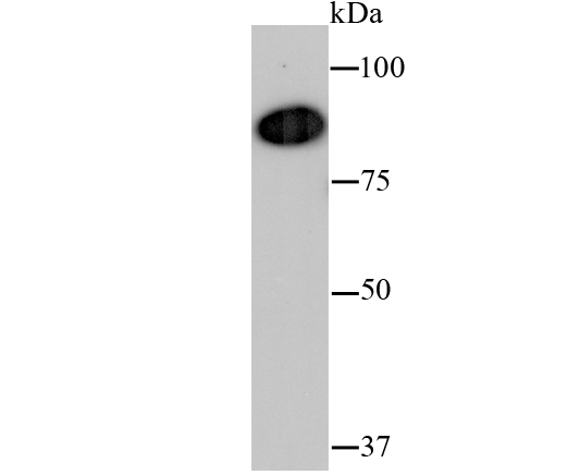 VCP Rabbit mAb