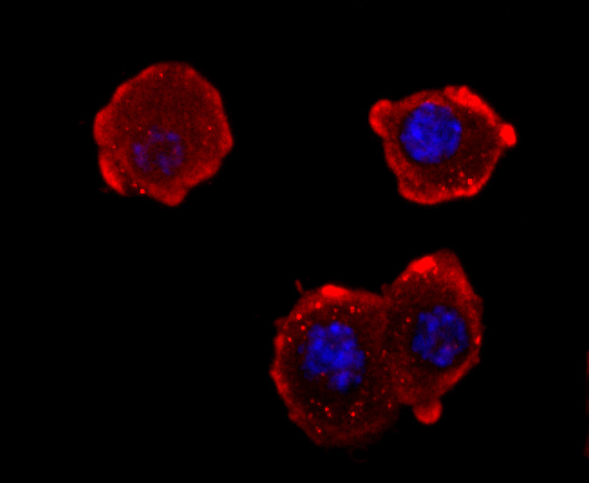 NEFM Rabbit mAb