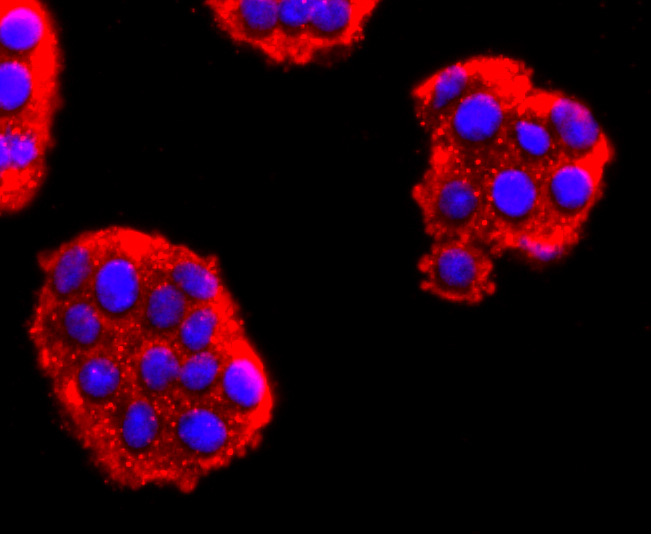 NEFM Rabbit mAb