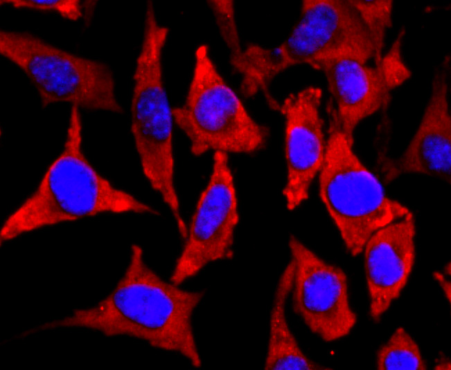 NEFM Rabbit mAb