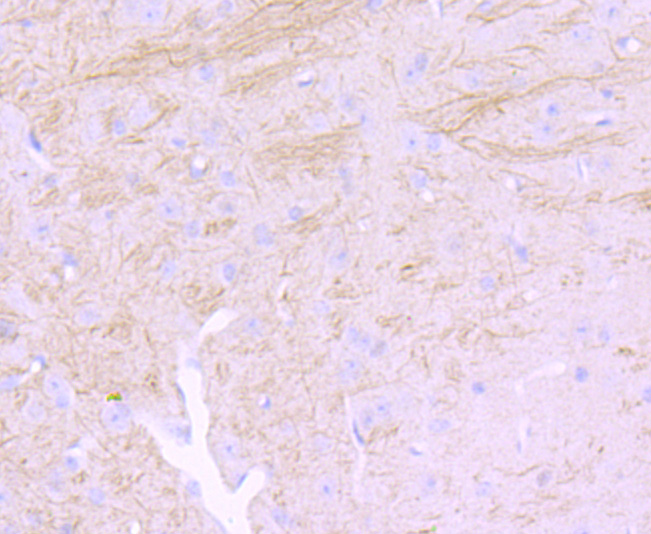 NEFM Rabbit mAb