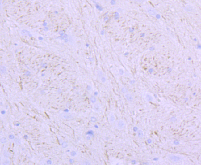 NEFM Rabbit mAb