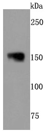 NEFM Rabbit mAb