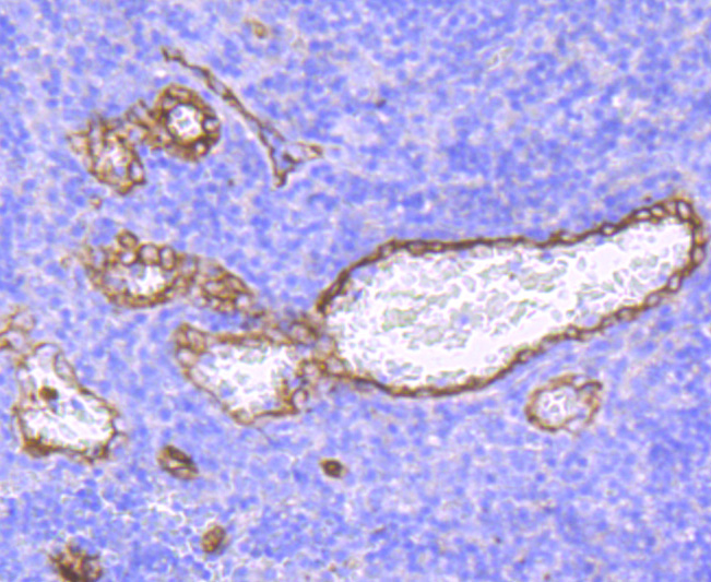 Claudin 5 Rabbit mAb