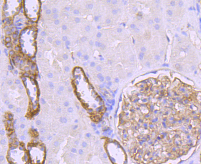 Claudin 5 Rabbit mAb