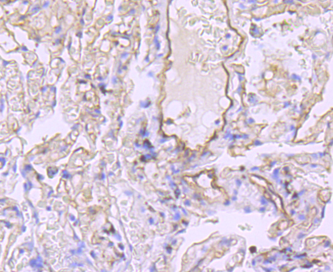 Claudin 5 Rabbit mAb