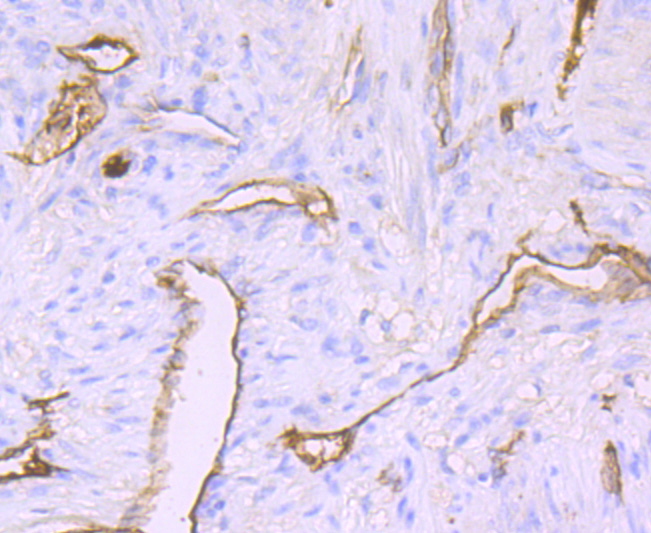 Claudin 5 Rabbit mAb