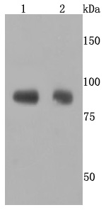 ADAM10 Rabbit mAb