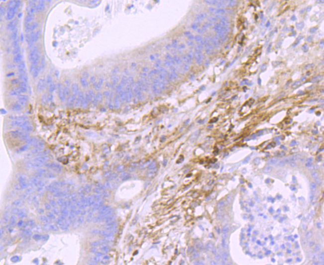 Podoplanin Rabbit mAb