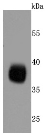 Podoplanin Rabbit mAb