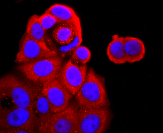 TNF Receptor II Rabbit mAb