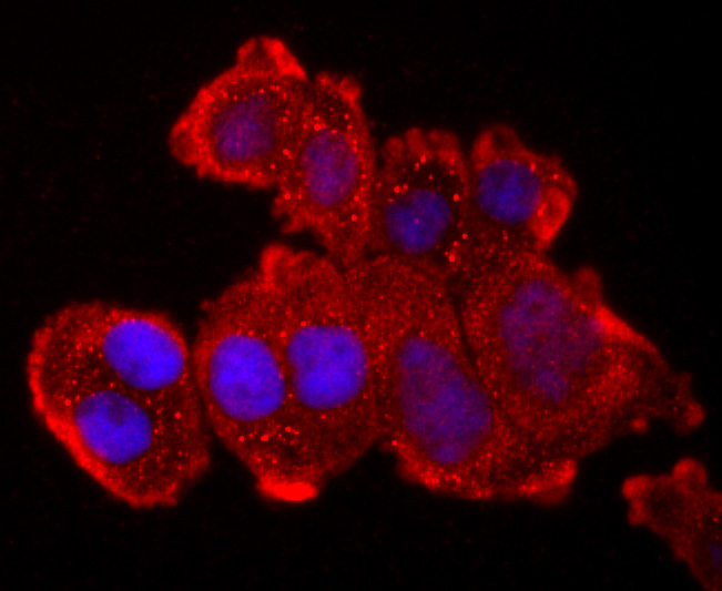 TNF Receptor II Rabbit mAb