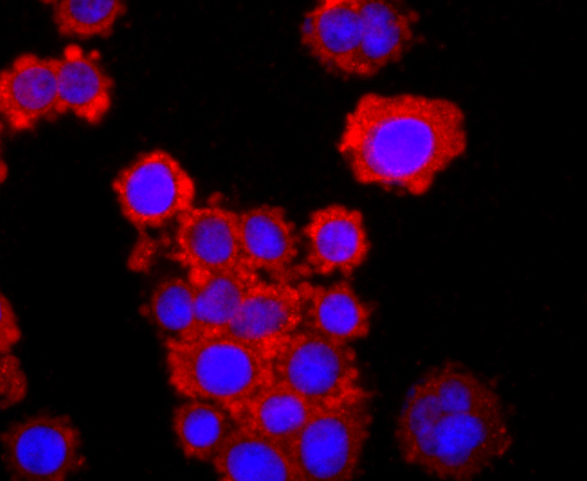 TNF Receptor II Rabbit mAb