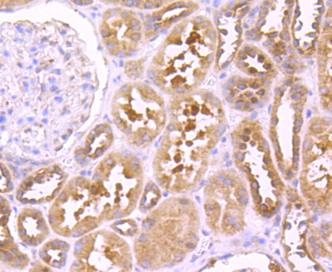 TNF Receptor II Rabbit mAb