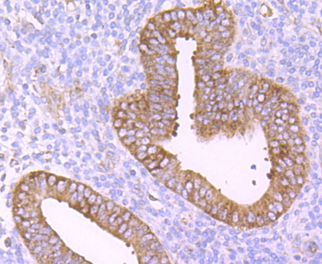 TNF Receptor II Rabbit mAb