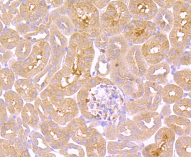 TNF Receptor II Rabbit mAb