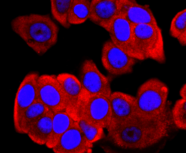 FGFR3 Rabbit mAb