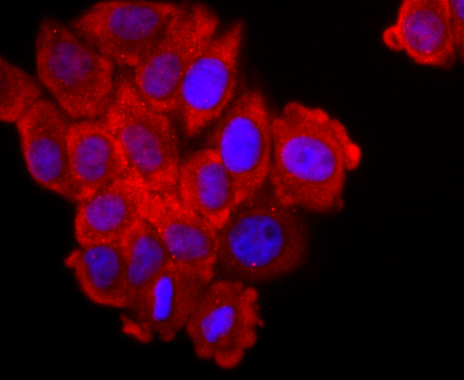 FGFR3 Rabbit mAb