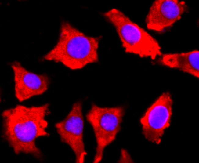 FGFR3 Rabbit mAb