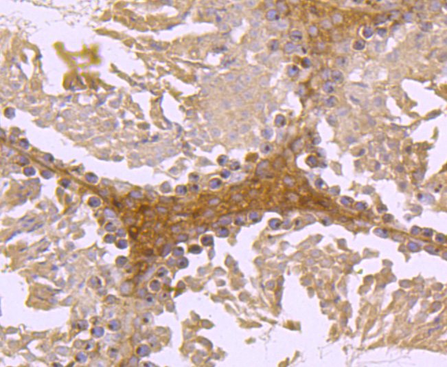 FGFR3 Rabbit mAb