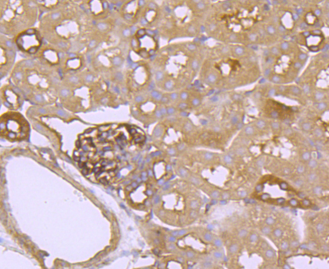 FGFR3 Rabbit mAb