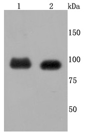 FGFR3 Rabbit mAb