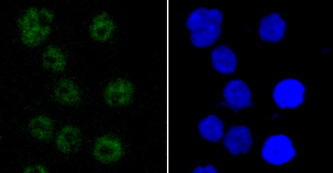 PABPN1 Rabbit mAb