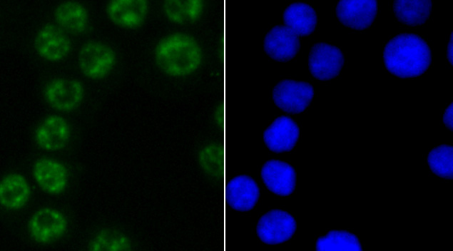 PABPN1 Rabbit mAb