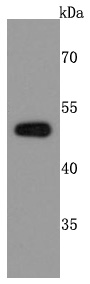 PABPN1 Rabbit mAb